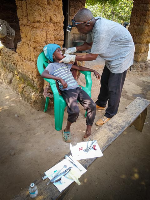 In early January, Ernest Tarawalie, in spite of his accident, made arrangements for a dentist to make an emergency visit to our village and pull the first of three aching teeth from the mouth of a young boy.