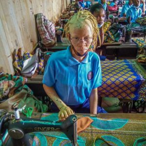 Albinism often affects a victim’s eyes. Therefore, Africa Surgery provides reading glasses to students who need them.